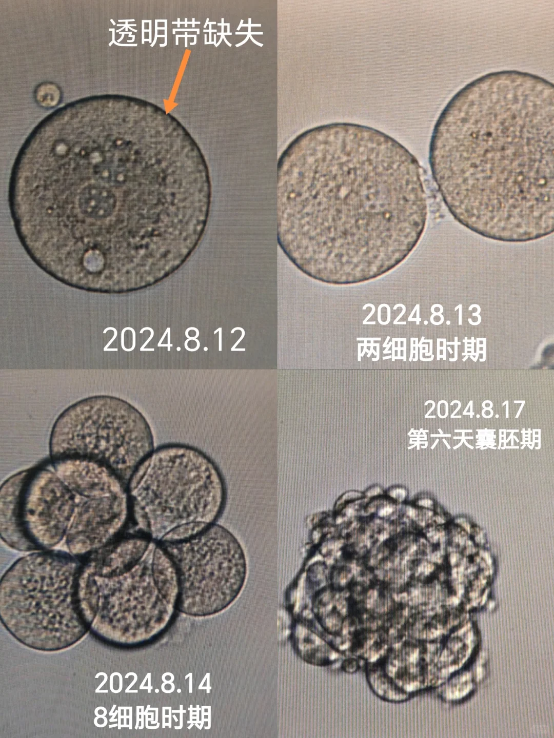 2026天津代生医院排名，警惕天津地下供卵医院地址电话